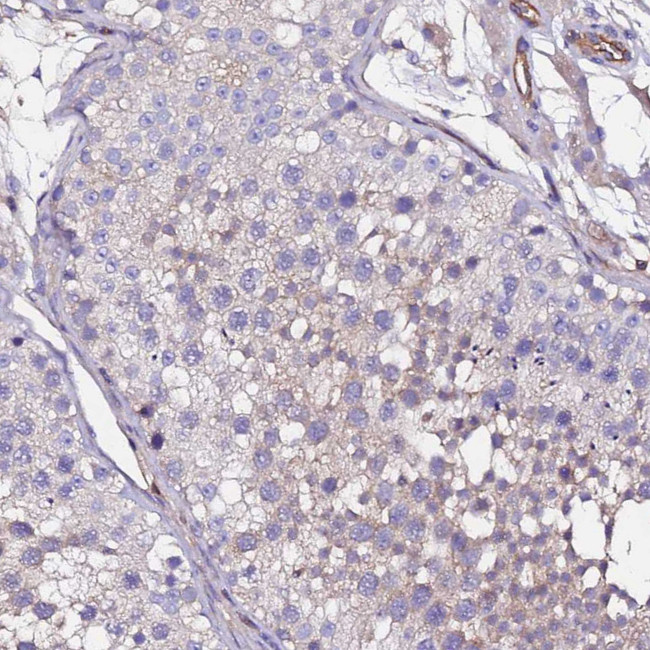 POTEE Antibody in Immunohistochemistry (Paraffin) (IHC (P))