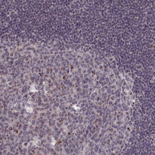 PPAN Antibody in Immunohistochemistry (Paraffin) (IHC (P))