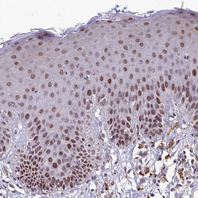 FAM108A1 Antibody in Immunohistochemistry (Paraffin) (IHC (P))