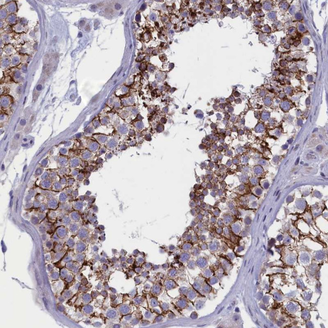 FAM129C Antibody in Immunohistochemistry (Paraffin) (IHC (P))