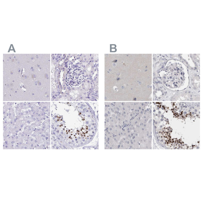 SPACA1 Antibody in Immunohistochemistry (IHC)