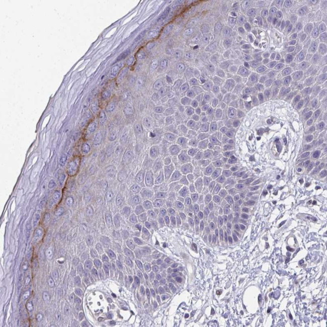 BPIL2 Antibody in Immunohistochemistry (Paraffin) (IHC (P))