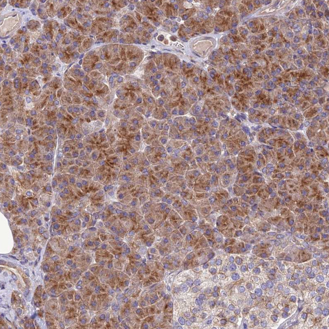 JMY Antibody in Immunohistochemistry (Paraffin) (IHC (P))