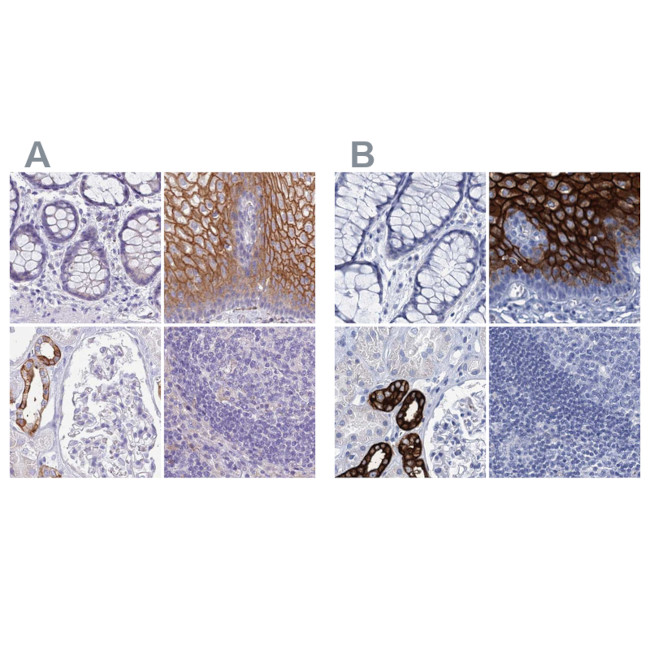 RHCG Antibody in Immunohistochemistry (IHC)