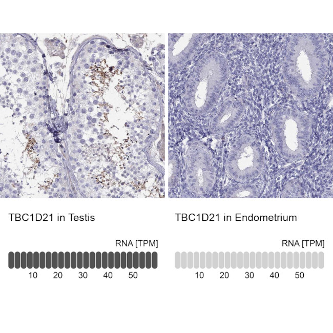 TBC1D21 Antibody in Immunohistochemistry (IHC)