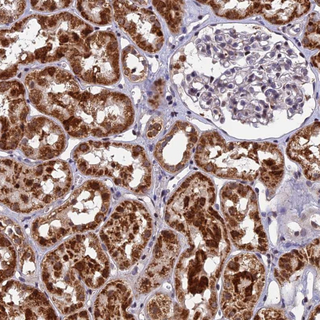 CMC1 Antibody in Immunohistochemistry (Paraffin) (IHC (P))