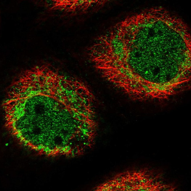 HIGD1A Antibody in Immunocytochemistry (ICC/IF)