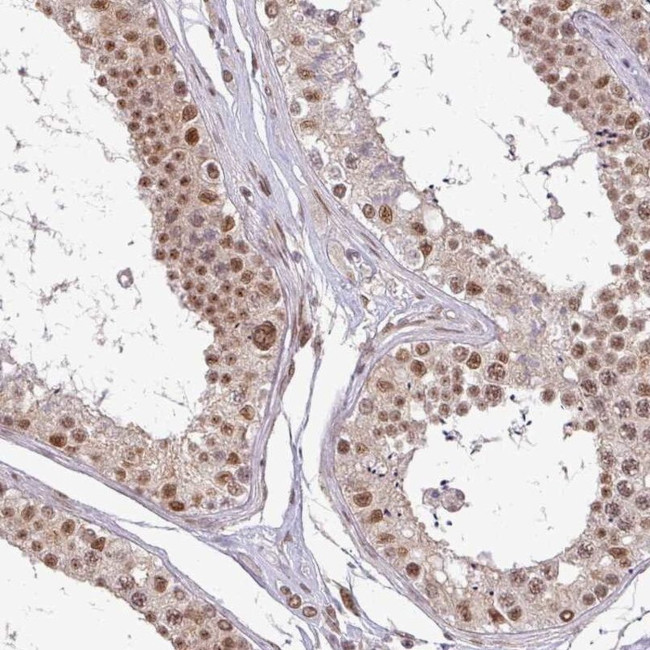 PTPN20A Antibody in Immunohistochemistry (IHC)
