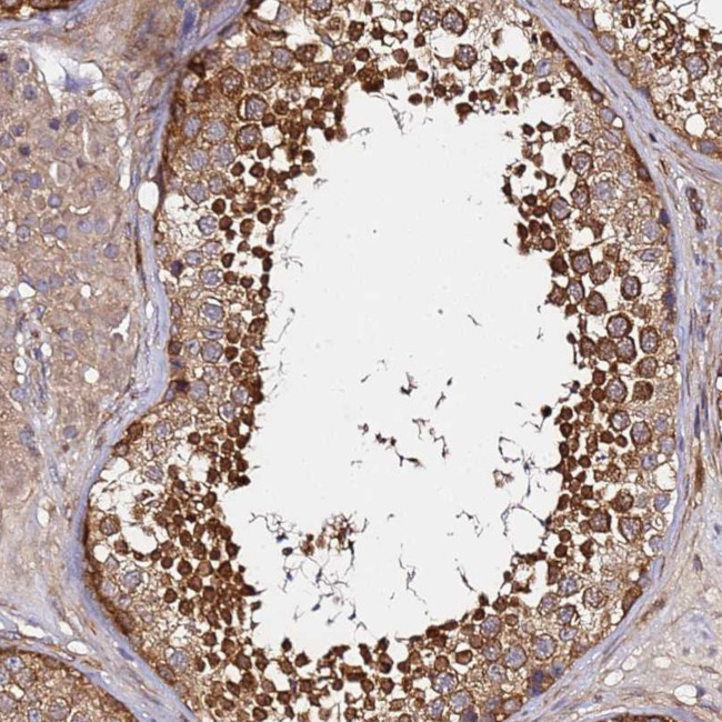 GNL1 Antibody in Immunohistochemistry (Paraffin) (IHC (P))