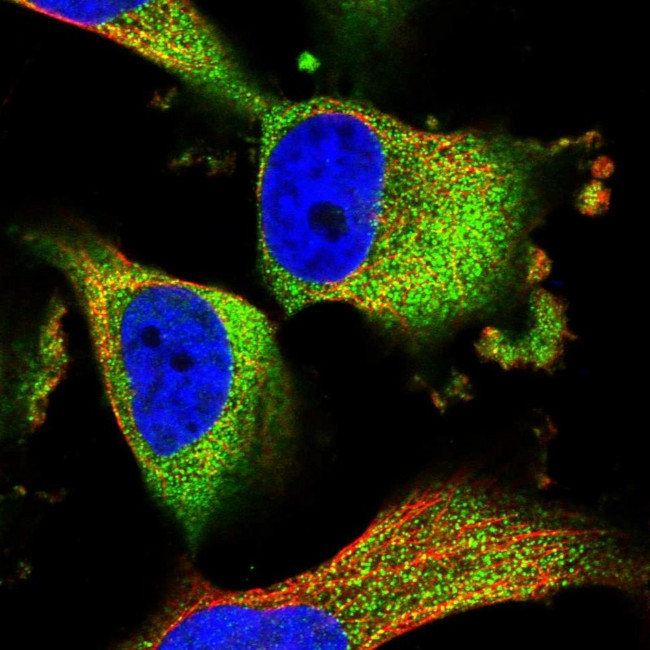 TMEM161A Antibody in Immunocytochemistry (ICC/IF)