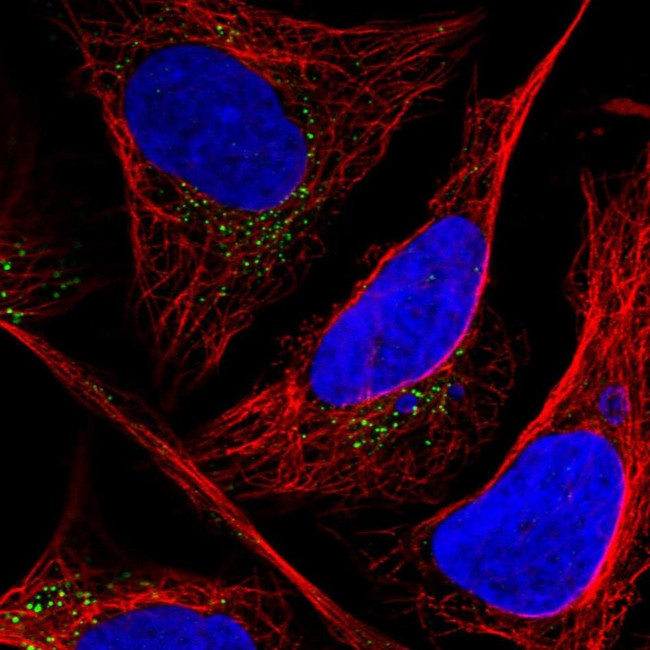 CLIP4 Antibody in Immunocytochemistry (ICC/IF)
