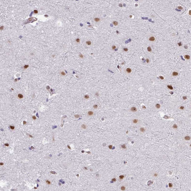 CHD3 Antibody in Immunohistochemistry (Paraffin) (IHC (P))