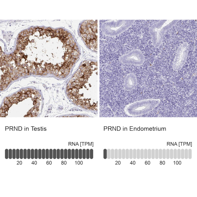 Doppel Antibody in Immunohistochemistry (IHC)