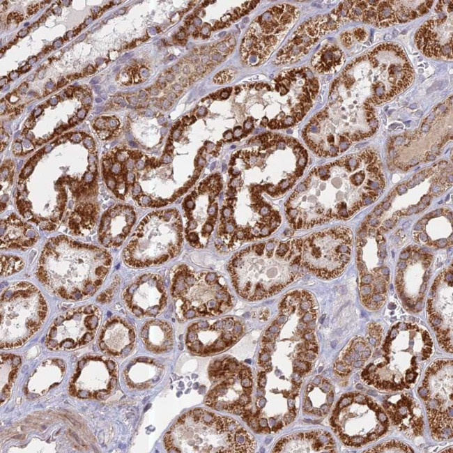 HMX2 Antibody in Immunohistochemistry (Paraffin) (IHC (P))