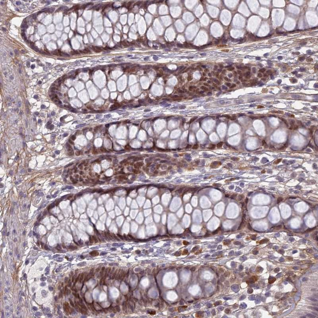 PABPN1L Antibody in Immunohistochemistry (Paraffin) (IHC (P))