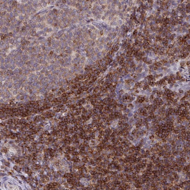 RASAL3 Antibody in Immunohistochemistry (Paraffin) (IHC (P))