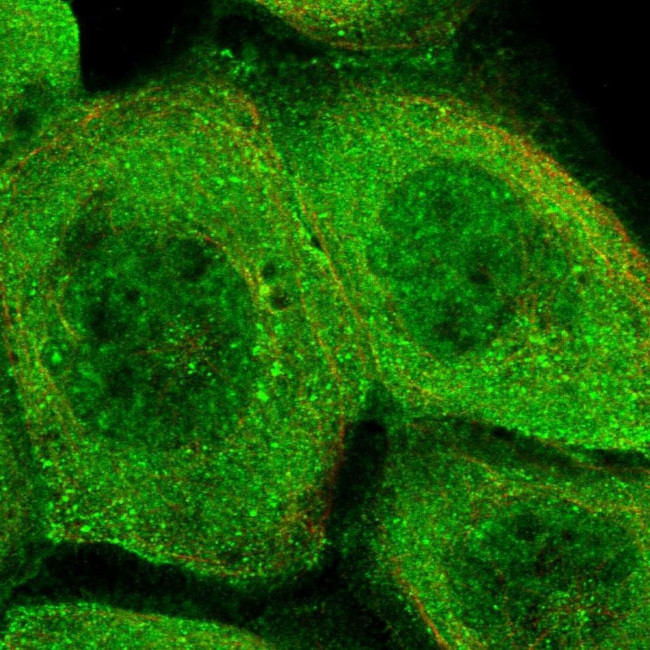 PHLB3 Antibody in Immunocytochemistry (ICC/IF)