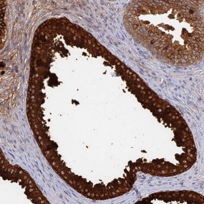 GPATCH1 Antibody in Immunohistochemistry (Paraffin) (IHC (P))