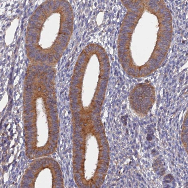 SLC38A11 Antibody in Immunohistochemistry (IHC)