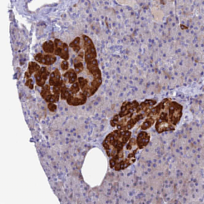 C5orf30 Antibody in Immunohistochemistry (Paraffin) (IHC (P))