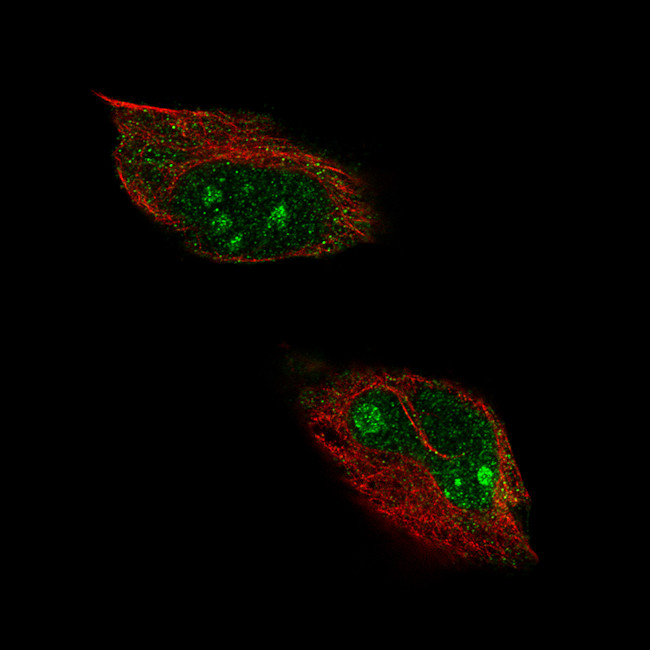 CD027 Antibody in Immunocytochemistry (ICC/IF)