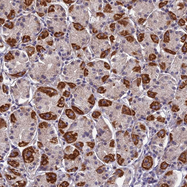 PLAC9 Antibody in Immunohistochemistry (Paraffin) (IHC (P))