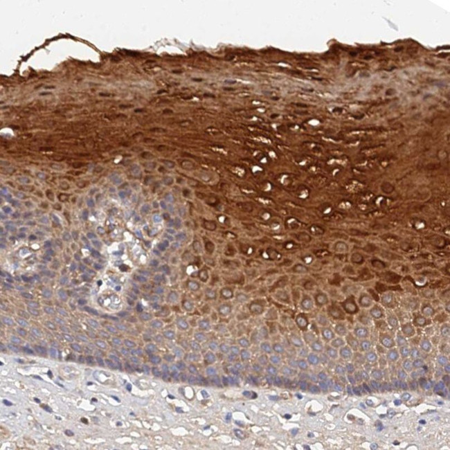 MRPL35 Antibody in Immunohistochemistry (IHC)