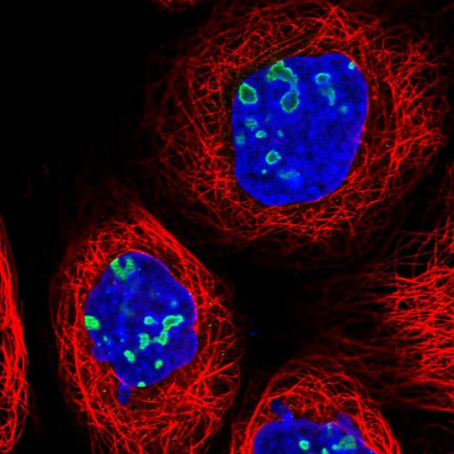 RSL1D1 Antibody in Immunocytochemistry (ICC/IF)