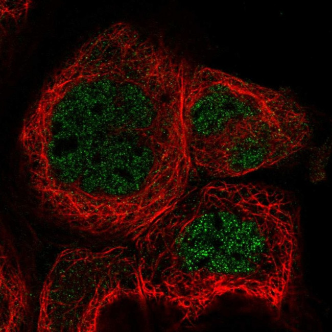 RABGGTA Antibody in Immunocytochemistry (ICC/IF)