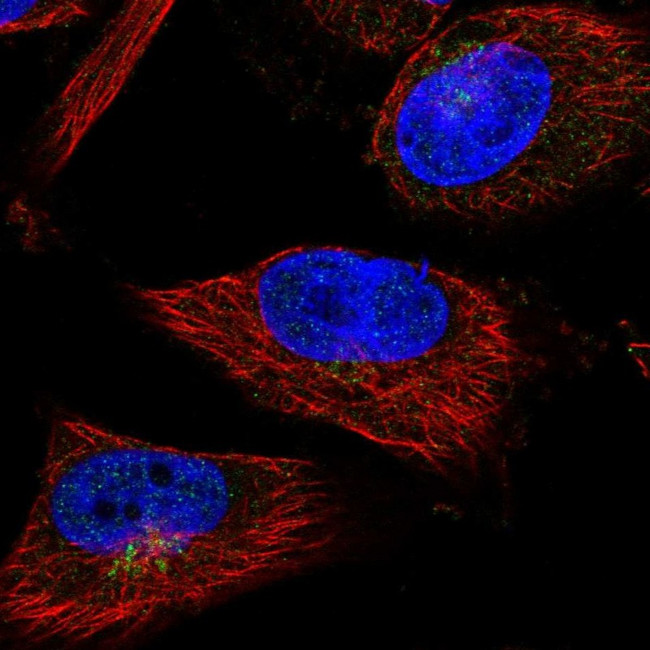SHFM3 Antibody in Immunocytochemistry (ICC/IF)