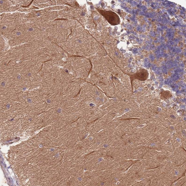 RAPGEF3 Antibody in Immunohistochemistry (Paraffin) (IHC (P))
