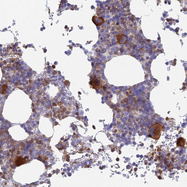 STRN4 Antibody in Immunohistochemistry (Paraffin) (IHC (P))