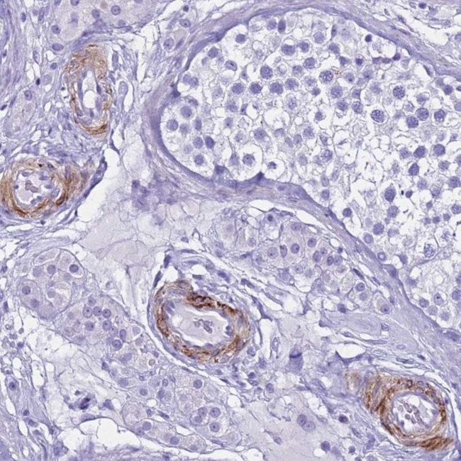 LCMT1 Antibody in Immunohistochemistry (IHC)