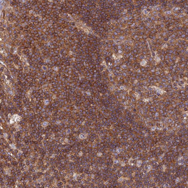 PPP1R12C Antibody in Immunohistochemistry (Paraffin) (IHC (P))