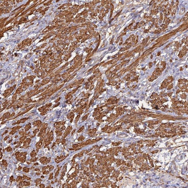 CCDC154 Antibody in Immunohistochemistry (Paraffin) (IHC (P))