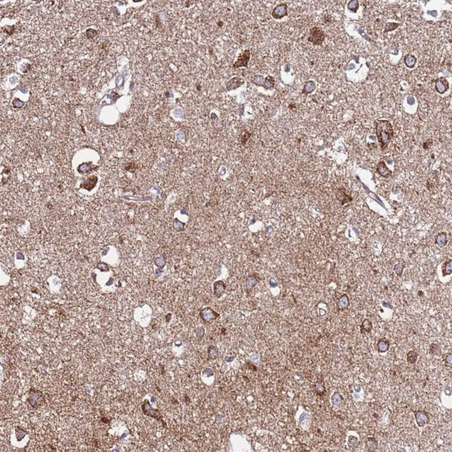 EVA1B Antibody in Immunohistochemistry (Paraffin) (IHC (P))