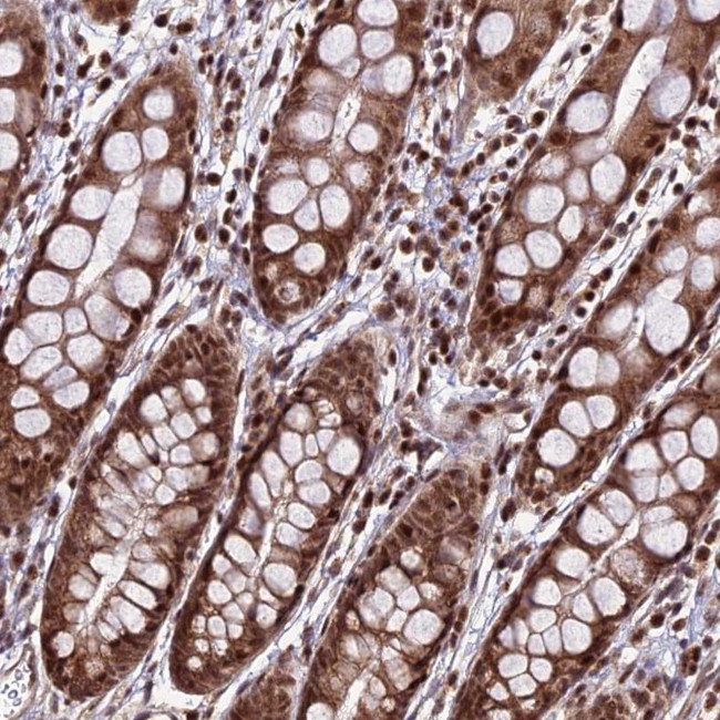 CIB3 Antibody in Immunohistochemistry (Paraffin) (IHC (P))