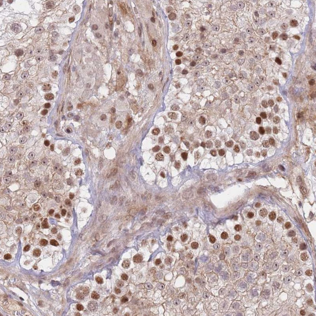 ERICH6B Antibody in Immunohistochemistry (Paraffin) (IHC (P))