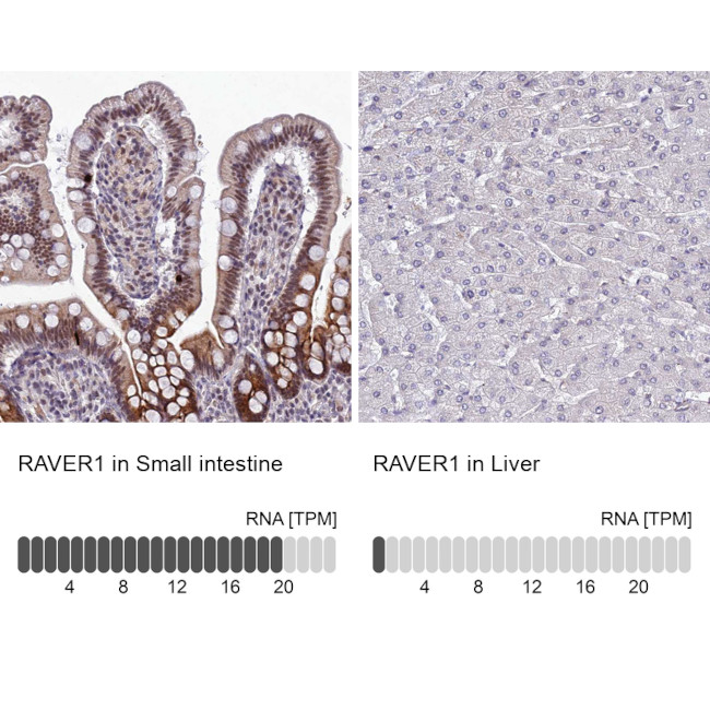 RAVER1 Antibody in Immunohistochemistry (IHC)