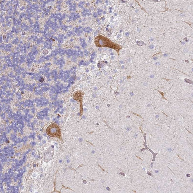 AADACL4 Antibody in Immunohistochemistry (Paraffin) (IHC (P))