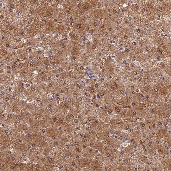 SLC25A41 Antibody in Immunohistochemistry (Paraffin) (IHC (P))