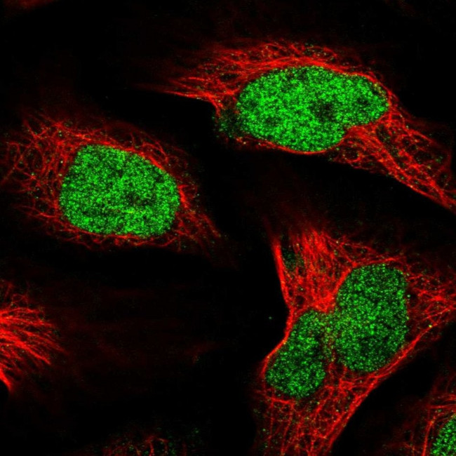 CT112 Antibody in Immunocytochemistry (ICC/IF)
