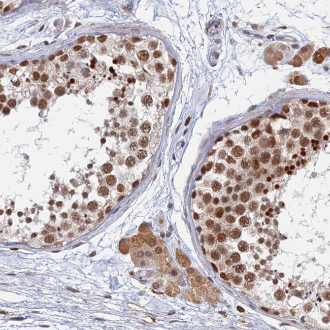 GPATCH1 Antibody in Immunohistochemistry (Paraffin) (IHC (P))