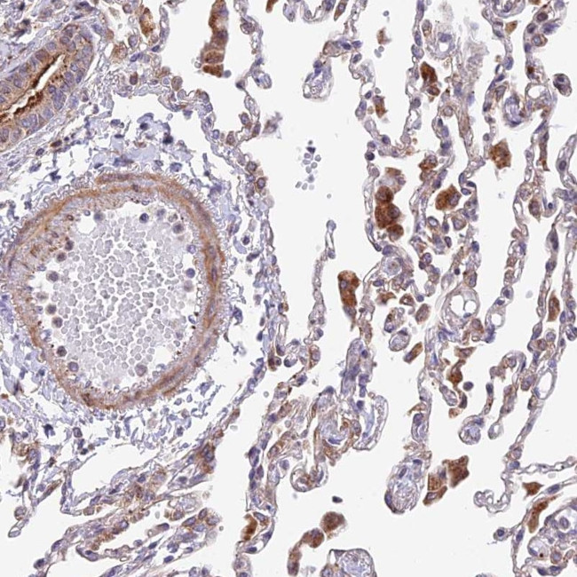 TBC1D20 Antibody in Immunohistochemistry (Paraffin) (IHC (P))