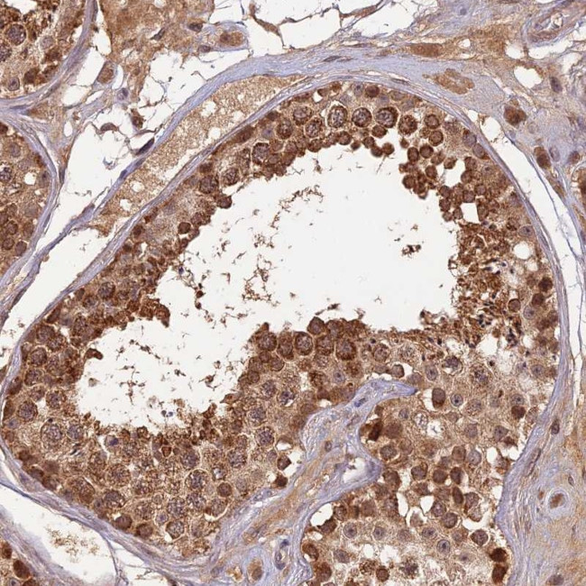 RGL3 Antibody in Immunohistochemistry (Paraffin) (IHC (P))