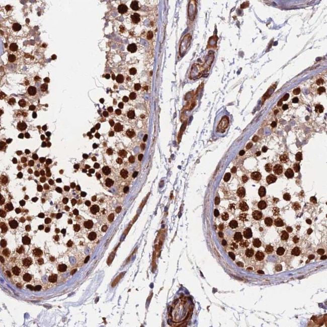 RALGAPA2 Antibody in Immunohistochemistry (IHC)