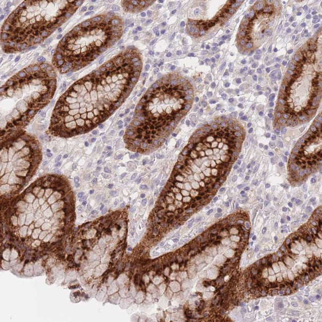 LOH12CR1 Antibody in Immunohistochemistry (Paraffin) (IHC (P))