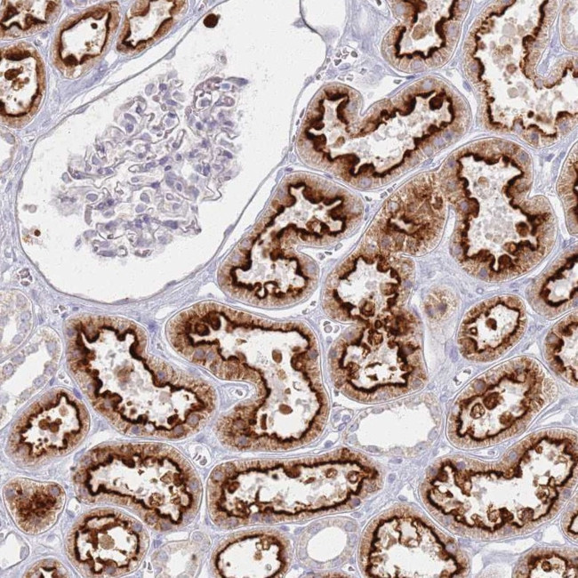 PKD2L2 Antibody in Immunohistochemistry (Paraffin) (IHC (P))
