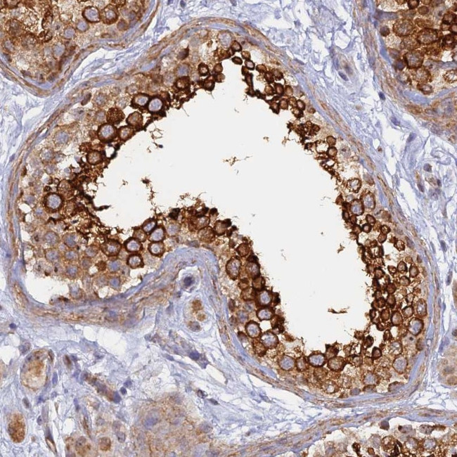 WDR62 Antibody in Immunohistochemistry (Paraffin) (IHC (P))