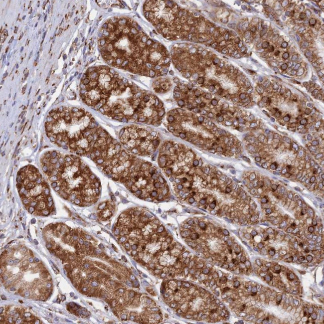 CCDC69 Antibody in Immunohistochemistry (Paraffin) (IHC (P))